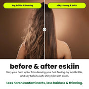 View Eskiin Filtered Showerhead With Filters For Healthy Hair & Skin image 3